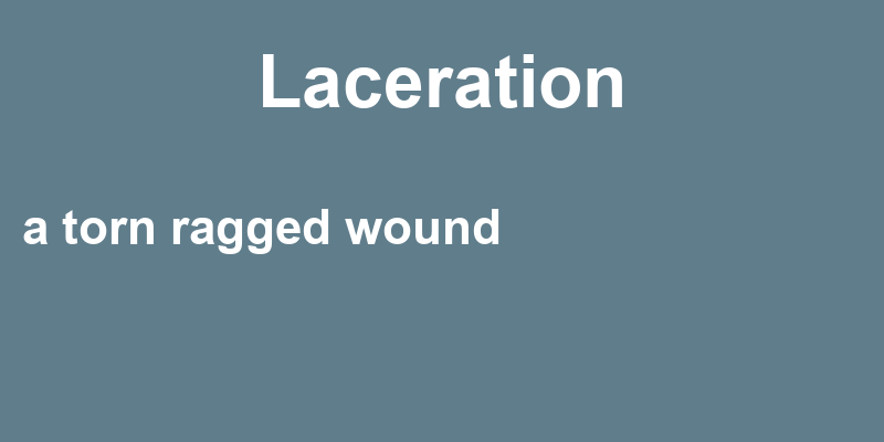 Definition of laceration